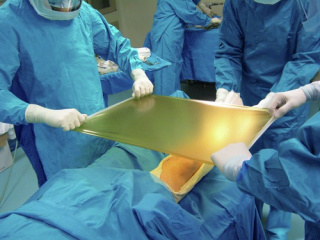 Medline Dermadrape*transparente Inzisionsfolie 40 x 40 cm / Klebefläche 34 x 40 cm